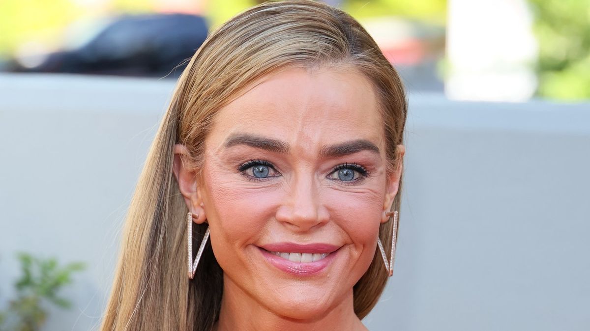 Denise Richards Sparks Reactions With Striking Facelift Before-and-After Photos